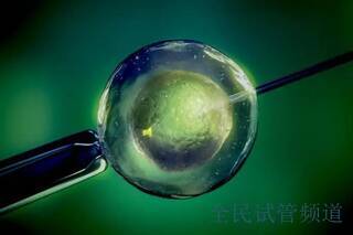 男性精子成活率要达到多少才能成功泰国做试管婴儿怀孕?