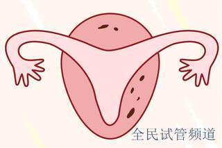 泰国试管费用对比,三代贵在何处