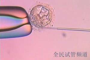 2025中国试管医院排行揭晓，顶尖机构名单出炉