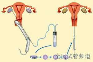 2025西安未婚试管机构名单，未婚试管选择指南