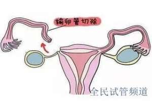 试管婴儿费用解析,两位女性生育成本对比