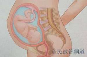试管婴儿成功率排行，权威医院榜单揭晓