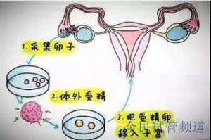 泰国试管费用预算，助您圆梦,三代试管费用详解