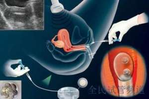 2025长春试管医院排名，成功率费用全解析