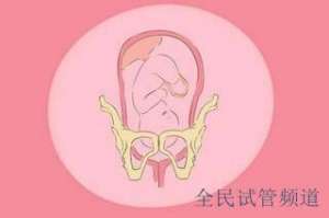 泰国试管三代费用明细,多少钱才够