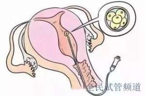 泰国助孕生子费用明细,详细预算解析