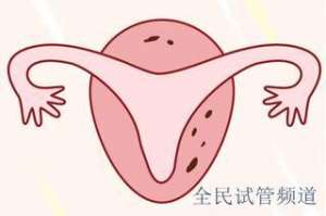 泰国试管费用对比,三代贵在何处