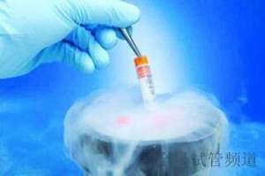 泰国试管费用明细表,哪些费用可以节省