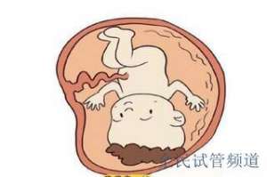 2025南充试管费用明细,助孕流程全解析