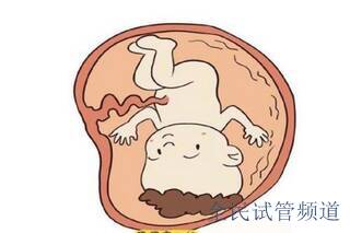 什么因素会导致宫腔粘连？