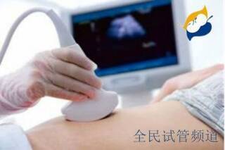 不孕不育有哪些常见的问题？
