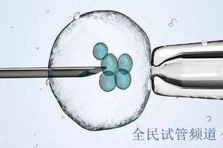 做试管婴儿,有必要做宫腔镜检查吗?