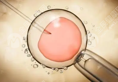 镇江想做试管婴儿怎么办?医院怎么选?