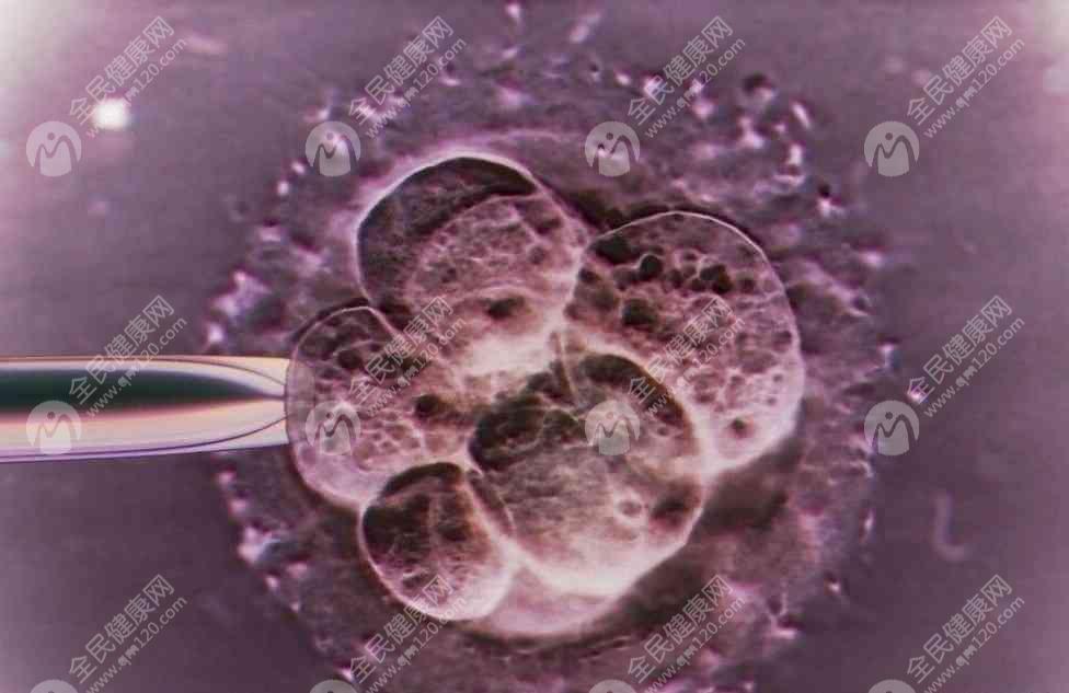 做三代试管婴儿医学指征条件有哪些呢？