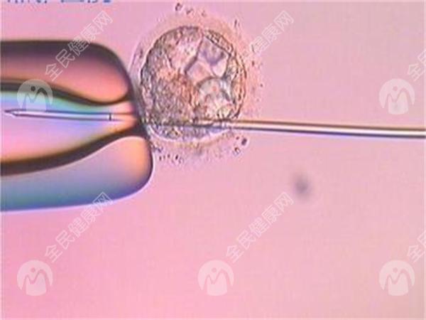 南宁区妇幼做第三代试管婴儿的价格参考，附费用明细分享！