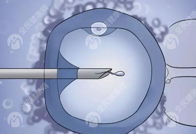 山南洛扎县试管婴儿可以做吗？