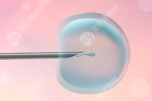 多囊卵巢综合症促排过程辛苦吗?效果怎么样?