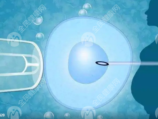 洛阳瀍河回族区试管婴儿哪家医院好?