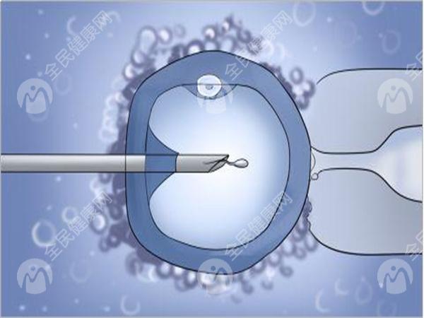 先天性卵巢功能发育不全能自然怀孕吗？能不能做试管婴儿？