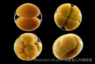 试管婴儿内膜调理