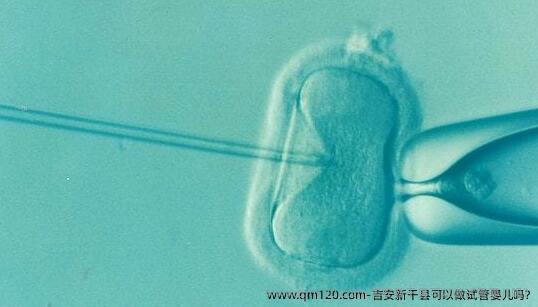 吉安新干县可以做试管婴儿吗?
