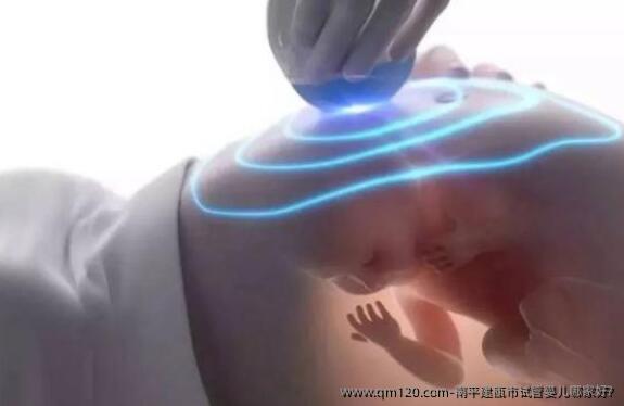 南平建瓯市试管婴儿哪家好?