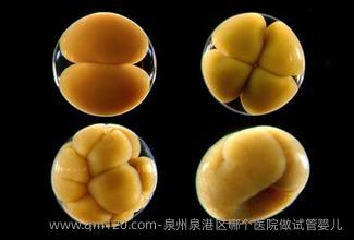 泉州泉港区哪个医院做试管婴儿