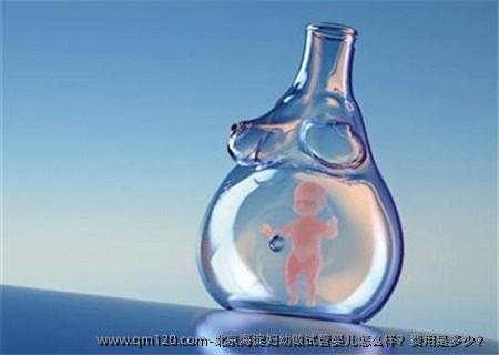北京海淀妇幼做试管婴儿怎么样？费用是多少？