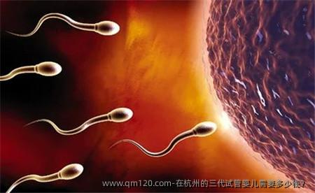 在杭州的三代试管婴儿需要多少钱？