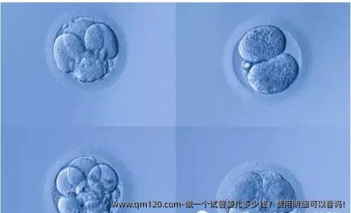 做一个试管婴儿多少钱？费用明细可以看吗!