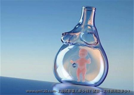 上海试管婴儿多少钱？试管一次性费用是多少？
