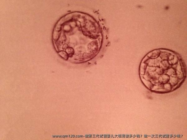 做第三代试管婴儿大概需要多少钱？做一次三代试管多少钱？