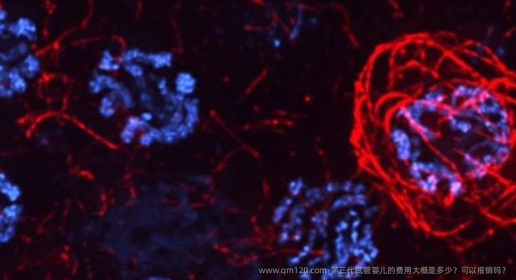 第三代试管婴儿的费用大概是多少？可以报销吗？