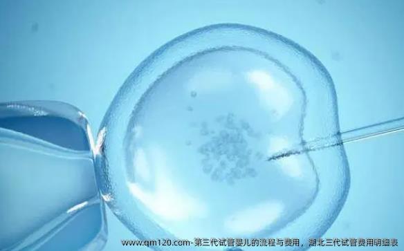 第三代试管婴儿的流程与费用，湖北三代试管费用明细表