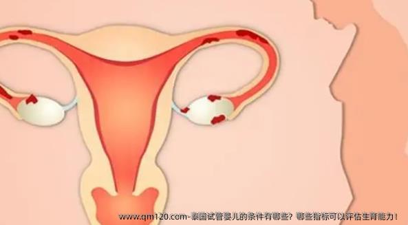 泰国试管婴儿的条件有哪些？哪些指标可以评估生育能力！