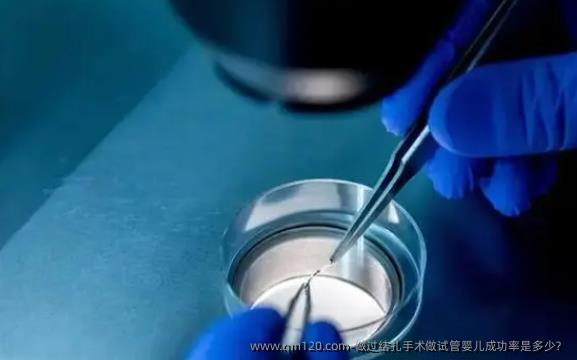 做过结扎手术做试管婴儿成功率是多少？
