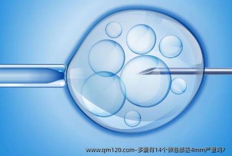 多囊有14个卵泡都是4mm严重吗？