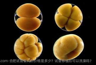 合肥试管婴儿的价格是多少？试管移植后可以洗澡吗？