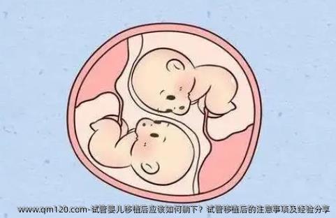试管婴儿移植后应该如何躺下？试管移植后的注意事项及经验分享