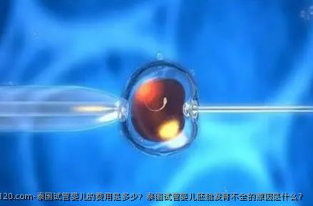 泰国试管婴儿的费用是多少？泰国试管婴儿胚胎发育不全的原因是什么？