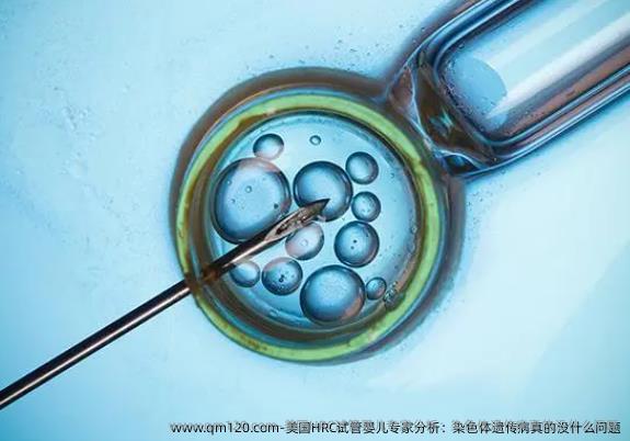 美国HRC试管婴儿专家分析：染色体遗传病真的没什么问题