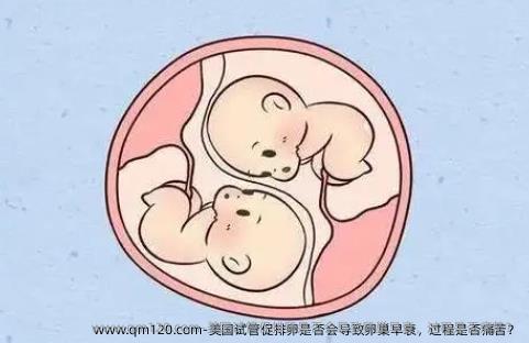美国试管促排卵是否会导致卵巢早衰，过程是否痛苦？