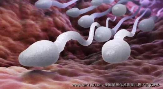 美国第三代试管婴儿技术的优缺点