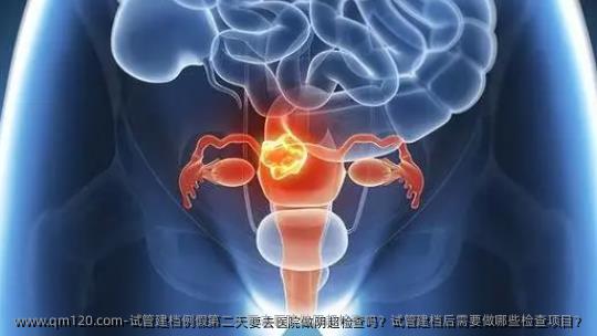 试管建档例假第二天要去医院做阴超检查吗？试管建档后需要做哪些检查项目？
