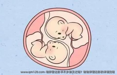 输卵管造影手术步骤及过程？做输卵管造影的详细流程
