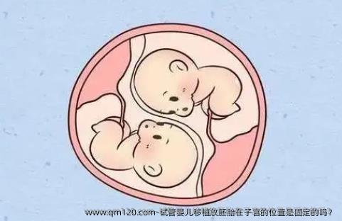 试管婴儿移植放胚胎在子宫的位置是固定的吗？