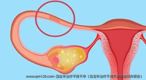 昌吉市治疗不育不孕（昌吉市治疗不育不孕的医院有哪些）
