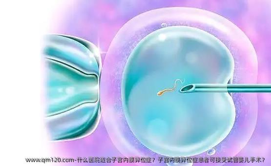 什么医院适合子宫内膜异位症？子宫内膜异位症患者可接受试管婴儿手术？