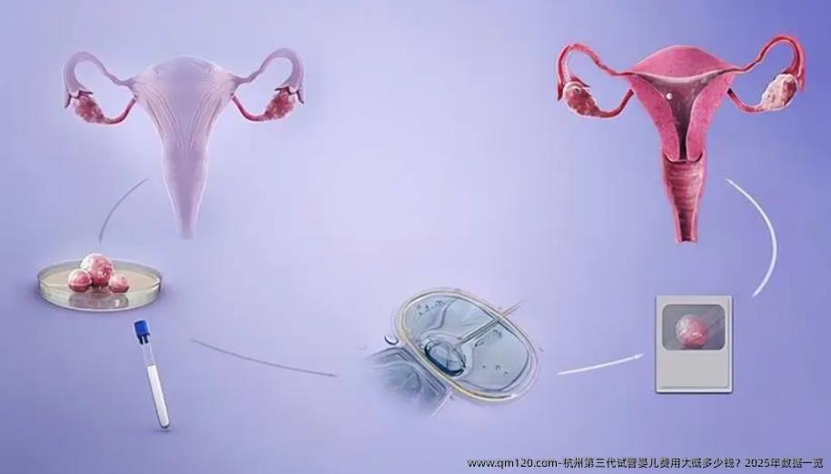 杭州第三代试管婴儿费用大概多少钱？2025年数据一览