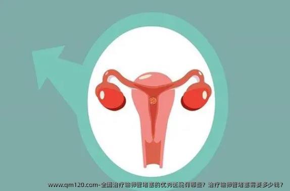 国内治疗输卵管堵塞的优秀医院有哪些？治疗输卵管堵塞需要多少钱？